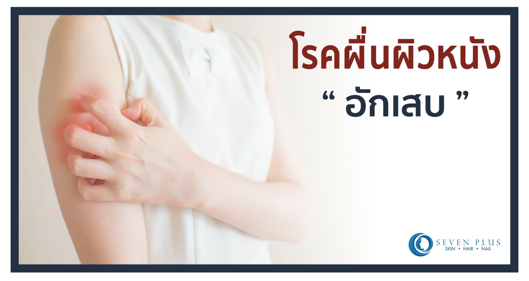 โรคผื่นผิวหนังอักเสบ
