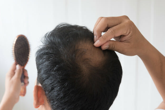 hair loss treatment bangkok