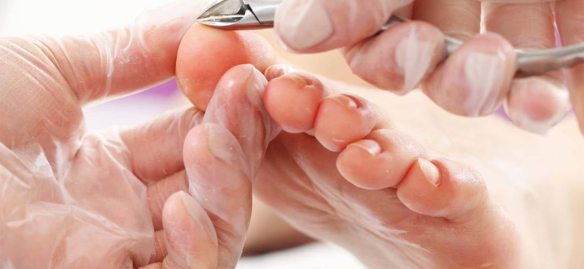 stop ingrown nails