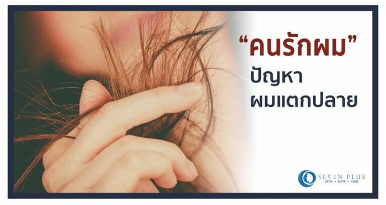 “คนรักผม” 